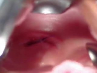 Изключителен клуб: рейчъл гинекомастия рефлектор изричен извратен гинекомастия преглед от стар медицински мъж